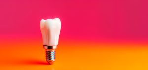 ventajas implantes dentales