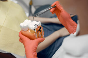que es una endodoncia