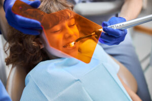 qué es el sellado de dientes